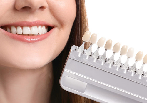 Imagem ilustrando a durabilidade da faceta e lente de contato dentária